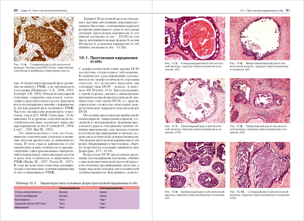 Рак молочной железы книги